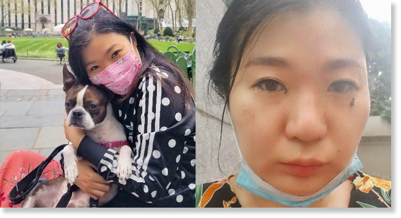Korean American artist Kate Bae was punched in the face in Manhattan on July 7, 2020. She had previously experienced taunts such as “Go back to China” in previous weeks. Photo via Next Shark website.